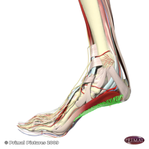 Plantar Fasciitis